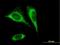 Solute Carrier Family 25 Member 24 antibody, H00029957-B01P, Novus Biologicals, Immunofluorescence image 