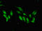 SWI/SNF Related, Matrix Associated, Actin Dependent Regulator Of Chromatin, Subfamily A Like 1 antibody, LS-C679554, Lifespan Biosciences, Immunofluorescence image 