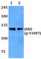 Janus Kinase 2 antibody, PA5-36658, Invitrogen Antibodies, Western Blot image 