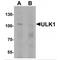 Unc-51 Like Autophagy Activating Kinase 1 antibody, MBS153694, MyBioSource, Western Blot image 