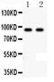 Cadherin 17 antibody, PA2200, Boster Biological Technology, Western Blot image 