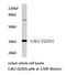 Cyclin Dependent Kinase 2 antibody, LS-C176902, Lifespan Biosciences, Western Blot image 