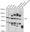 REL Proto-Oncogene, NF-KB Subunit antibody, 14-150, ProSci, Western Blot image 