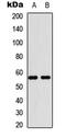 Membrane Bound Transcription Factor Peptidase, Site 2 antibody, abx121641, Abbexa, Western Blot image 