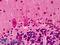 Leucine-rich repeat LGI family member 2 antibody, LS-B4973, Lifespan Biosciences, Immunohistochemistry paraffin image 