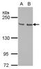 Kinesin Family Member 14 antibody, NBP2-17047, Novus Biologicals, Western Blot image 