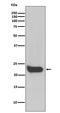 Interferon Beta 1 antibody, M02041, Boster Biological Technology, Western Blot image 