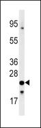 Frataxin antibody, MBS9215230, MyBioSource, Western Blot image 