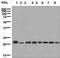 RAB7A, Member RAS Oncogene Family antibody, ab137029, Abcam, Western Blot image 
