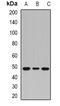 PHD Finger Protein 6 antibody, abx142144, Abbexa, Western Blot image 