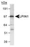 Lipin 1 antibody, PA1-16998, Invitrogen Antibodies, Western Blot image 