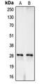 Carbonic Anhydrase 1 antibody, MBS820351, MyBioSource, Western Blot image 