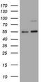 TNF Receptor Superfamily Member 8 antibody, M01225-1, Boster Biological Technology, Western Blot image 