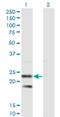 Signal Sequence Receptor Subunit 2 antibody, H00006746-M01, Novus Biologicals, Western Blot image 