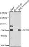 SET Domain Containing 3, Actin Histidine Methyltransferase antibody, GTX65538, GeneTex, Immunoprecipitation image 
