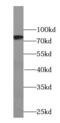 ENaC-Beta antibody, FNab09767, FineTest, Western Blot image 