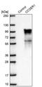 Coiled-Coil Serine Rich Protein 1 antibody, PA5-63011, Invitrogen Antibodies, Western Blot image 