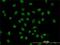 Serine And Arginine Rich Splicing Factor 10 antibody, H00010772-M03, Novus Biologicals, Immunocytochemistry image 