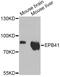 Erythrocyte Membrane Protein Band 4.1 antibody, A12434, ABclonal Technology, Western Blot image 