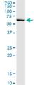 Serpin Family B Member 2 antibody, H00005055-M08, Novus Biologicals, Western Blot image 