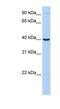 Arginase 2 antibody, NBP1-54389, Novus Biologicals, Western Blot image 