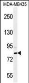 SET And MYND Domain Containing 4 antibody, PA5-48237, Invitrogen Antibodies, Western Blot image 