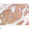 ATM Serine/Threonine Kinase antibody, LS-C813193, Lifespan Biosciences, Immunohistochemistry paraffin image 