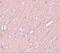 Synaptogyrin 3 antibody, A14692, Boster Biological Technology, Immunohistochemistry frozen image 