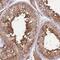 Protein Kinase CAMP-Dependent Type I Regulatory Subunit Alpha antibody, PA5-62112, Invitrogen Antibodies, Immunohistochemistry frozen image 