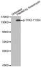 Tyrosine Kinase 2 antibody, abx000513, Abbexa, Western Blot image 