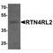 Reticulon 4 Receptor Like 2 antibody, MBS153580, MyBioSource, Western Blot image 