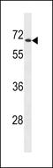 UDP Glucuronosyltransferase Family 2 Member B28 antibody, 60-762, ProSci, Western Blot image 