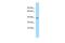 NDRG Family Member 3 antibody, PA5-45689, Invitrogen Antibodies, Western Blot image 