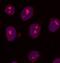 SET Domain Bifurcated Histone Lysine Methyltransferase 2 antibody, NB100-1137, Novus Biologicals, Immunocytochemistry image 