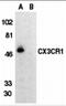 C-X3-C Motif Chemokine Receptor 1 antibody, 2201, ProSci, Western Blot image 
