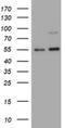 TNF Receptor Superfamily Member 8 antibody, NBP2-46157, Novus Biologicals, Western Blot image 