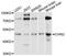Chimerin 2 antibody, STJ111666, St John
