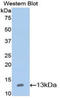 NPHS1 Adhesion Molecule, Nephrin antibody, LS-C301853, Lifespan Biosciences, Western Blot image 