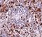 Epstein-Barr Virus Induced 3 antibody, A07190, Boster Biological Technology, Immunohistochemistry paraffin image 