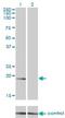 NME/NM23 Nucleoside Diphosphate Kinase 1 antibody, H00004830-M01, Novus Biologicals, Western Blot image 