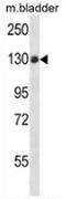 Protein Tyrosine Phosphatase Non-Receptor Type 14 antibody, AP53509PU-N, Origene, Western Blot image 