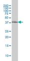 Rpo1-1 antibody, H00009533-M01, Novus Biologicals, Western Blot image 