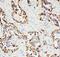 Paxillin antibody, PA5-79899, Invitrogen Antibodies, Immunohistochemistry paraffin image 