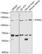 Protein Tyrosine Phosphatase Receptor Type A antibody, 18-424, ProSci, Western Blot image 
