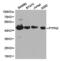 PTPN2 antibody, LS-C192885, Lifespan Biosciences, Western Blot image 