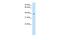 Proteasome 26S Subunit, Non-ATPase 6 antibody, PA5-40537, Invitrogen Antibodies, Western Blot image 