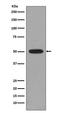 Tubulin Beta 4B Class IVb antibody, M09008, Boster Biological Technology, Western Blot image 