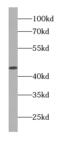 Alpha-(1,3)-fucosyltransferase antibody, FNab03253, FineTest, Western Blot image 