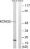 Potassium Voltage-Gated Channel Modifier Subfamily G Member 2 antibody, LS-B9854, Lifespan Biosciences, Western Blot image 