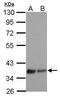 Lysophosphatidic Acid Receptor 3 antibody, PA5-27074, Invitrogen Antibodies, Western Blot image 